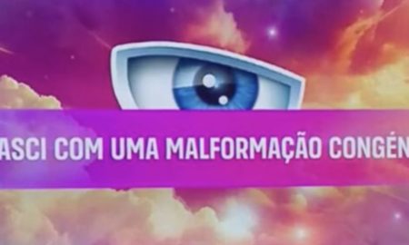 Segredo Secret Story - Mal formação