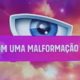 Segredo Secret Story - Mal formação