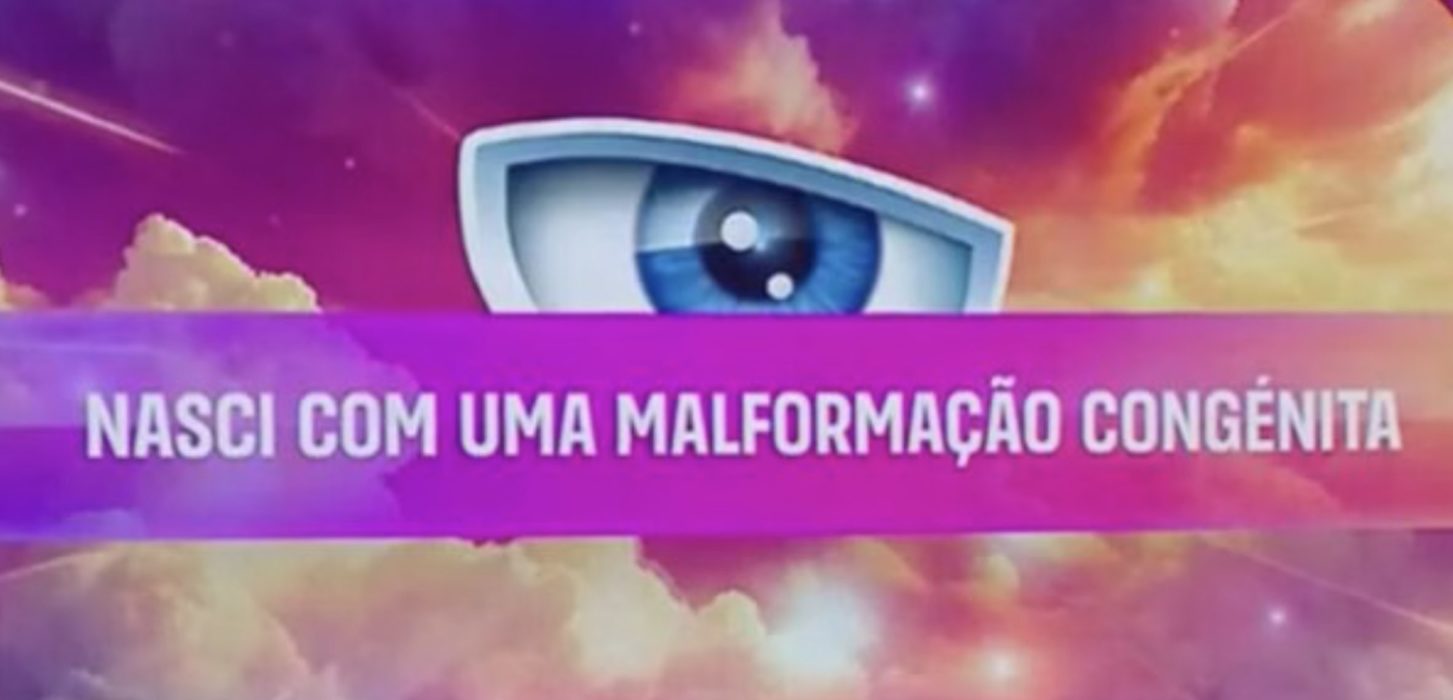 Segredo Secret Story - Mal formação